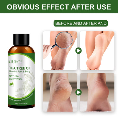 Repair Foot Heel Calluses Crack Exfoliating Skin Care Solution