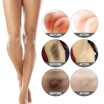 Skin Care Suit Fade Armpit Joint Thigh Melanin