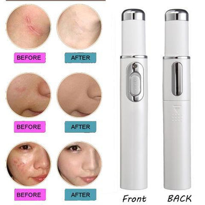 Blue Light Therapy Acne Laser Pen Soft Scar Wrinkle Removal Treatment Device Skin Care Beauty Equipment