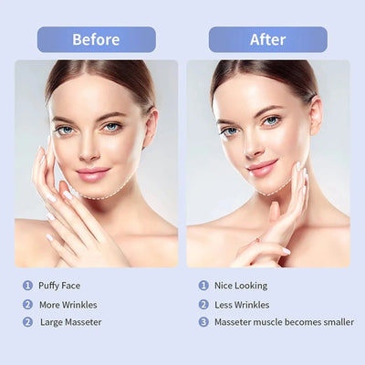 Electric V Face Facial Machine V-Line Up Lift Belt Face Massage LED Face Skin Lifting Firming Double Chin Reducer Beauty Care - Steffashion