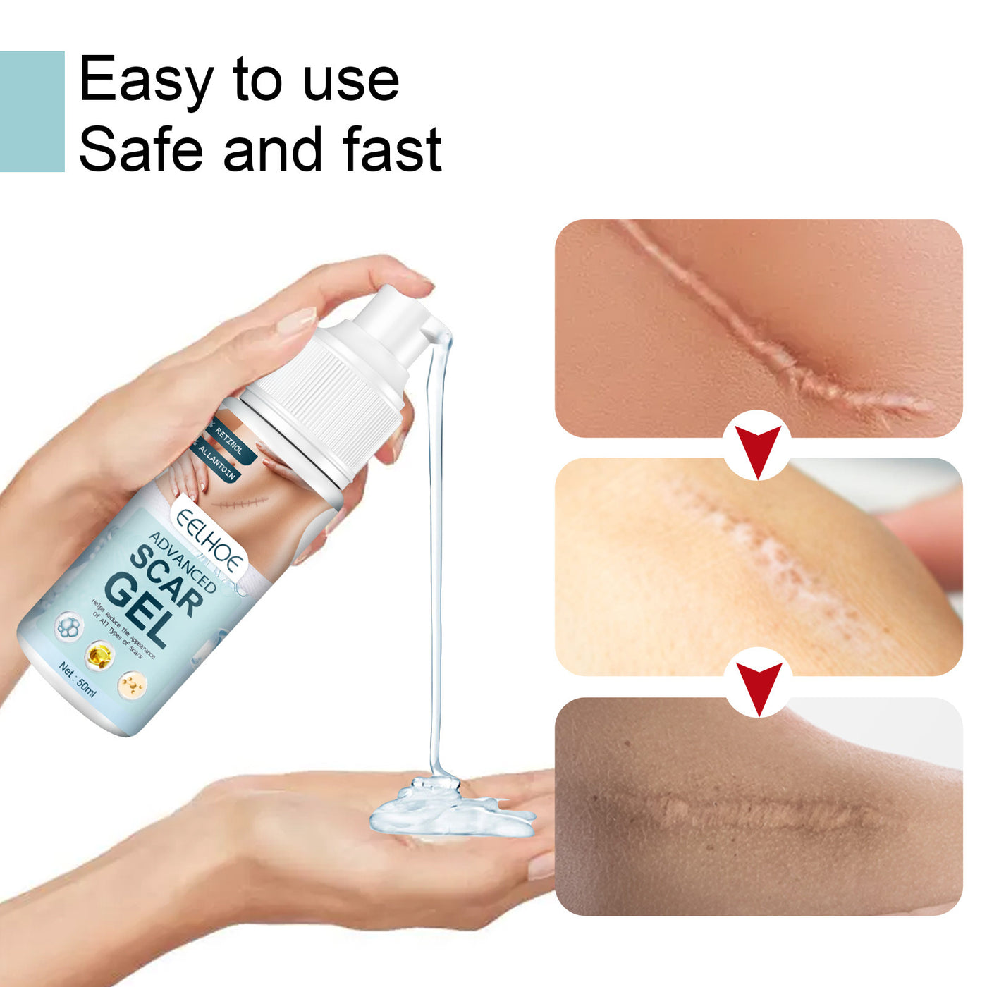 Fade Scar Gel Skin Hyperplasia Burning Care Smoothing Repair Marks