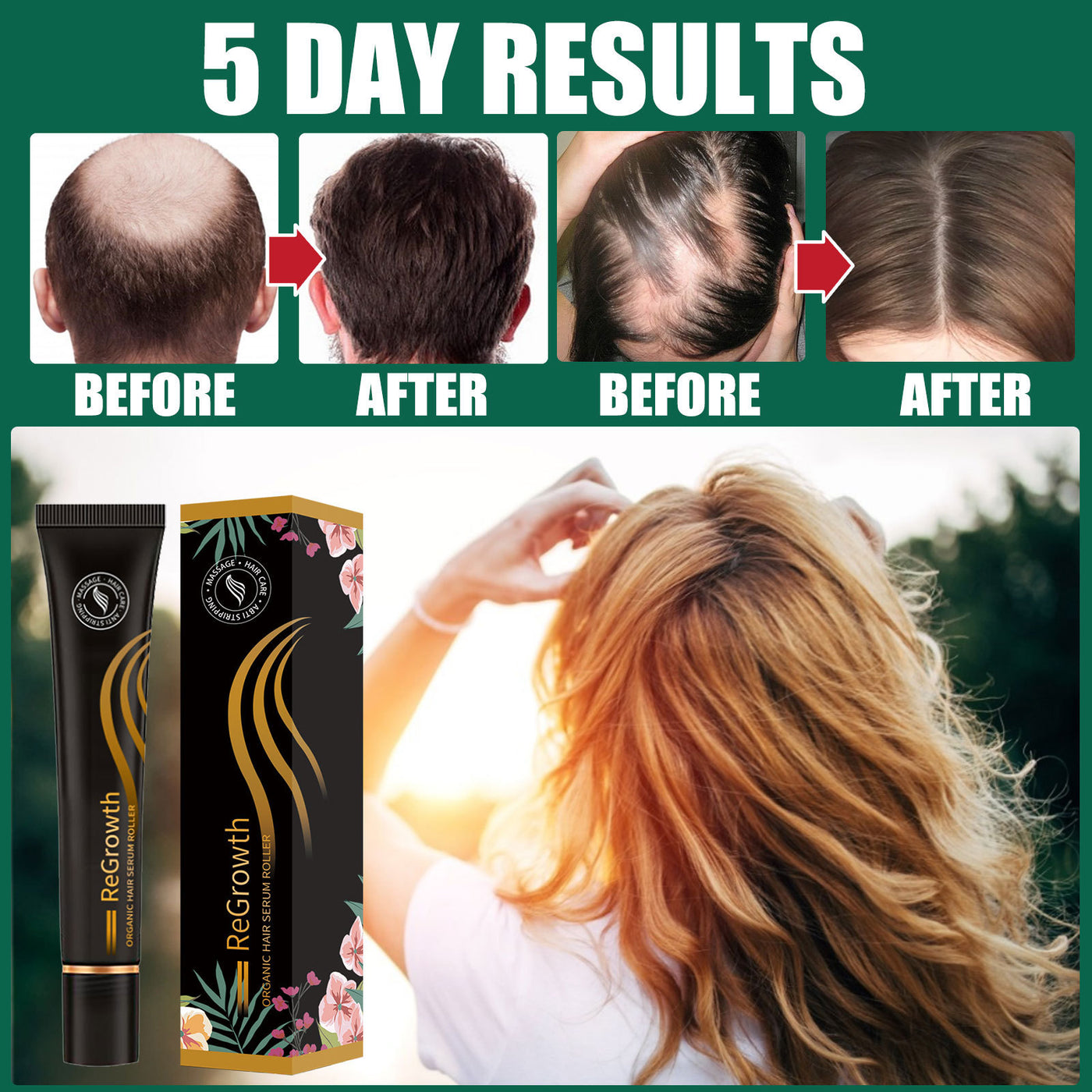 Regrowth Organic Hair Serum Roller Set Hair Care Anti Stripping Liquid Suitable For All Types Of Hair Loss Scalp Nourishing